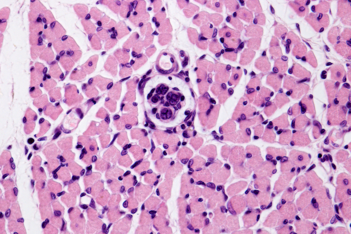 MUSCLE SPINDLE (CROSS SECTION)